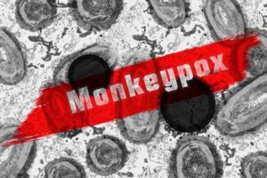 ICMR Alert; Children At Higher Risk Of Monkeypox Virus